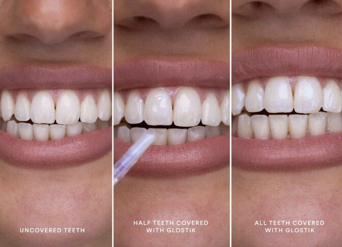 hismile - Glostik Tooth Gloss 4ml